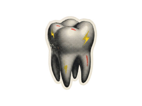 Vintage halftone illustration of a molar tooth with yellow lightning bolts and pain marks on transparent background