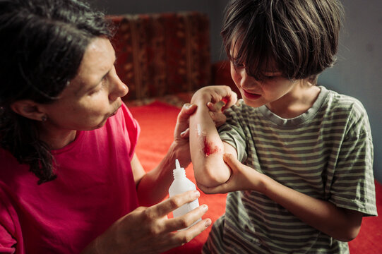 Mother cleans bleeding wound on child arm indoors