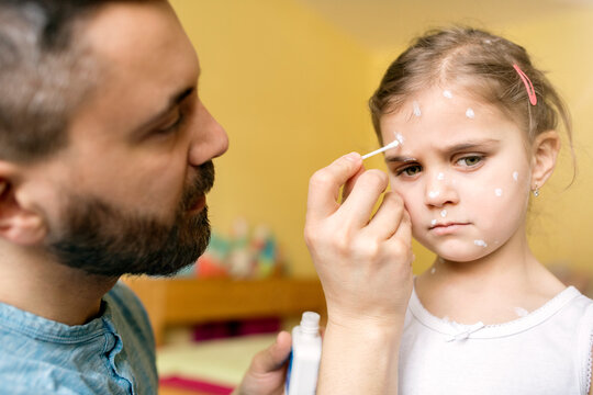 Father at home caring for daughter having chickenpox