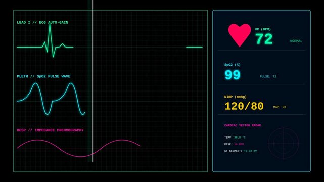 Digital Medical Patient Monitor Screen Display Showing Vital Signs and Heart Rate Pulse Wave Data