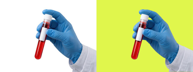 Scientist holding blood sample in test tube