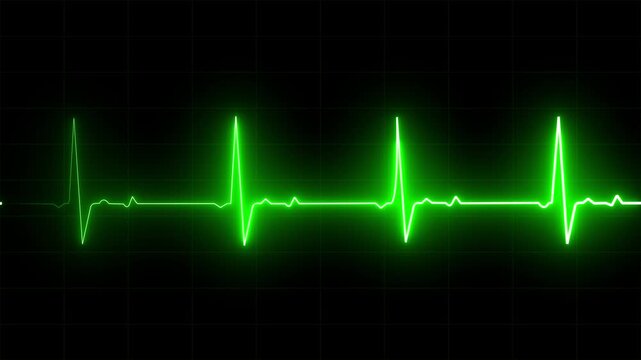 Bright green heartbeat line showing a pulse on a dark digital medical monitor screen used for hospital health check and cardiology heart rate rhythm analysis in emergency room clinical setting