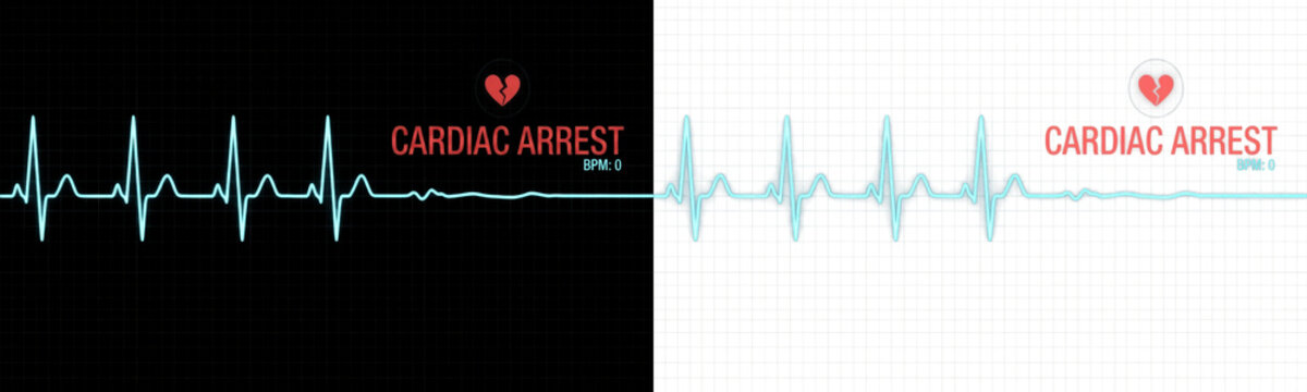 A transparent PNG file featuring a digital cardiac arrest heart monitor graphic with zero BPM and a flatline pulse. Ideal for medical and emergency design projects.