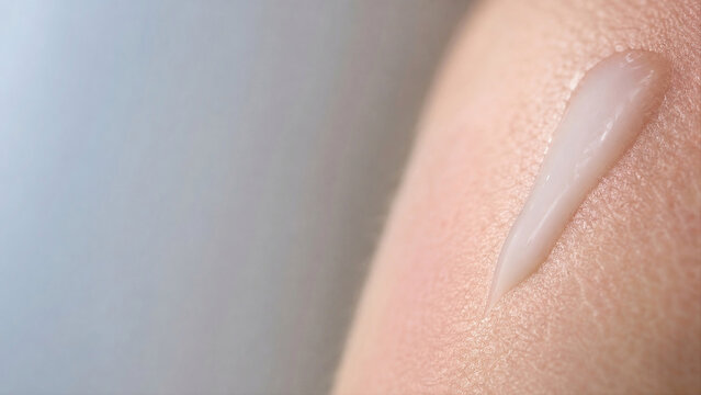 Niacinamide Serum Droplet Spreading on Sensitive Skin Macro - Barrier Repair
