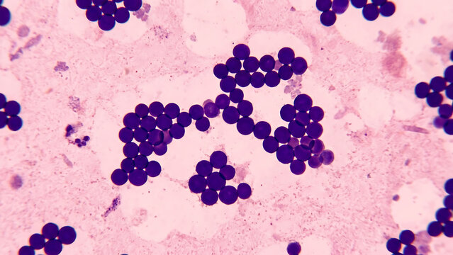abstract background with smear of gram positive cocci bacteria under 100x light microscope