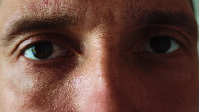 Close-up of a man's eyes and forehead highlighting natural skin texture, fine hairs, and subtle redness. The subject blinks slowly with minimal movement under steady, neutral lighting.
