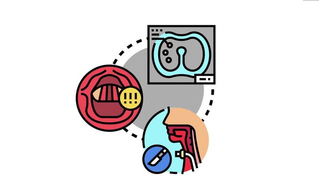 Larynx region medical s displaying diagnostic procedures, throat conditions, and surgical interventions for human respiratory system health and voice disorders