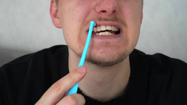 Dental hygiene, plaque removal with a toothbrush.
Dental health care.