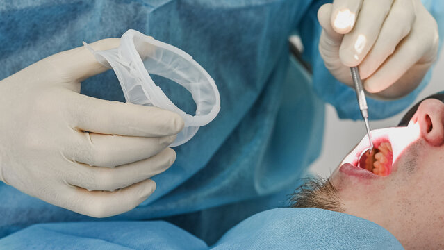 Dentist examining patient teeth with dental mirror after placing silicone mouth retractor, detailed close-up of oral examination without face visible
