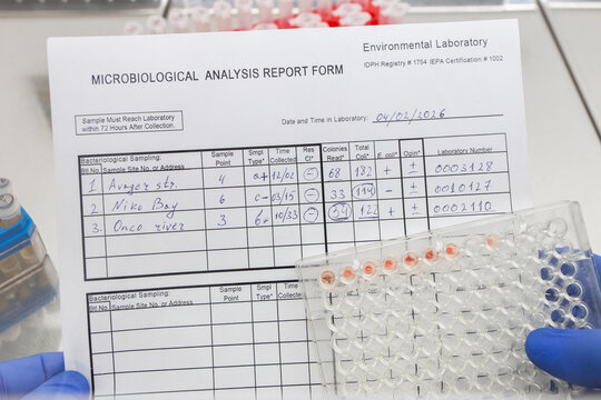 A close-up shot shows a scientist holding a laboratory report with results and an immunological plate displaying an agglutination reaction.