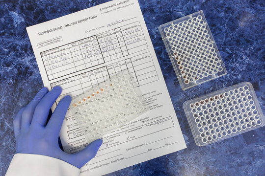 The scientist placed an immunological plate containing antibody reactions onto the laboratory protocol; additional plates lay on the table nearby.