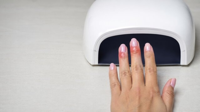 Red and swollen cuticles appear beneath a UV nail lamp after a pink gel manicure