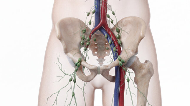 Lymphatic system in human pelvic anatomy shown with realistic 3D render of lymph nodes, iliac vessels, and hip bones, suitable for medical education and clinical oncology visuals