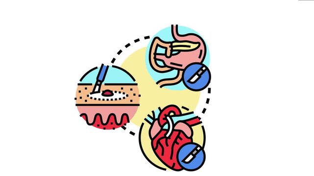 Surgical oncology procedure removing cancer cells from various organs using medical instruments, chemotherapy, biopsy, and therapeutic interventions for patient health
