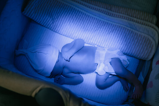 Newborn baby sleeping in a hospital cot under blue light, receiving phototherapy treatment for jaundice, reducing bilirubin levels and promoting healthy development