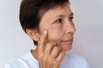 Mature woman points at facial wrinkles and aging skin, showing pigmentation, texture, age spots and...