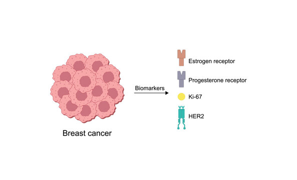 Breast cancer biomarkers, including estrogen receptors, progesterone receptors, Ki-67 and HER2. Vector illustration.