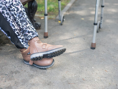 A Caucasian woman with cerebral palsy sits on a park bench. Close-up of her legs.