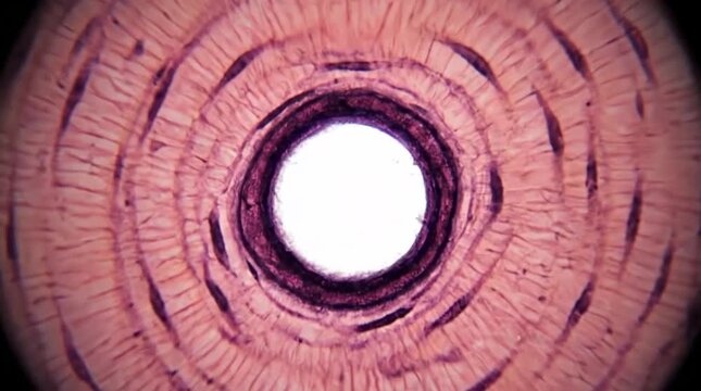 Microscopic zoom into bone tissue structure