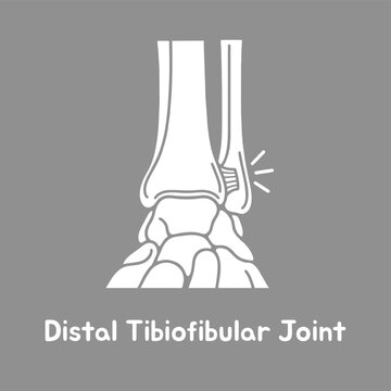 Distal tibiofibular joint anatomical diagram showing human ankle bones with white line art vector style