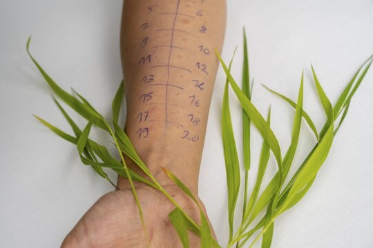 Allergy test, prick test, skin test, different ingredients are tested for allergic reactions, arm with markings and blades of grass, Germany