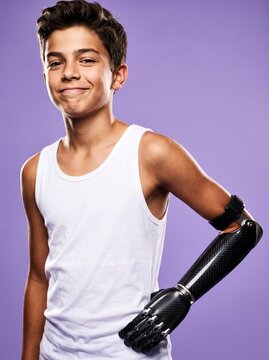 Confident teenage boy with a modern bionic prosthetic arm smiling in a studio setting
