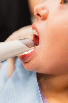 Patient receiving digital intraoral scan in dental clinic
