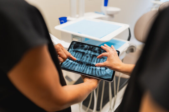 Dental professional discussing panoramic x ray on tablet with patient