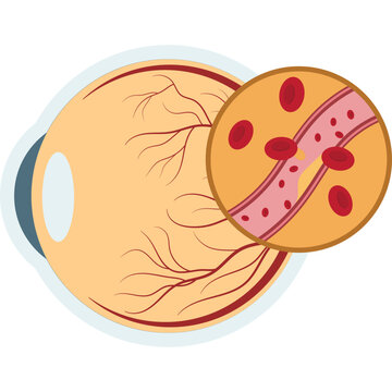 Illustration of World Diabetes Day designation