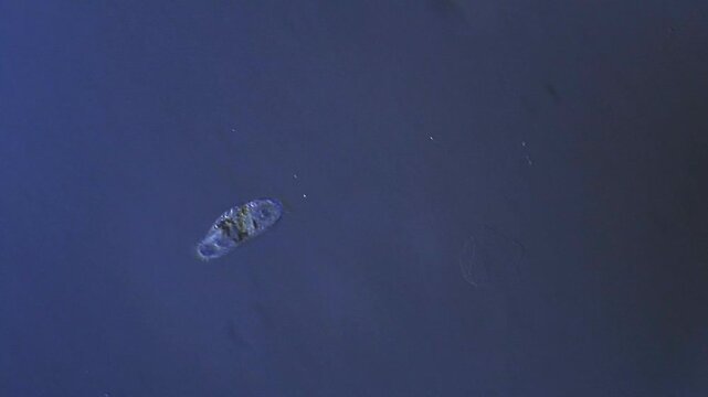 Micro organism - ciliate swimming