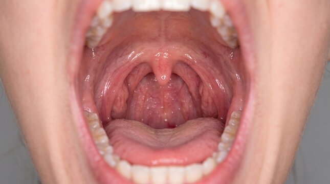 Close-Up View of an Open Human Mouth Showing Uvula, Tonsils, and Throat Anatomy Inside the Oral Cavity for Medical, Dental, and Health Education.
