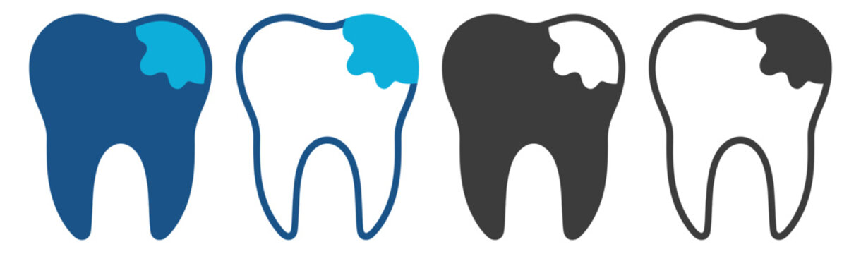 Tooth decay dental damage with cavity mark on transparent background