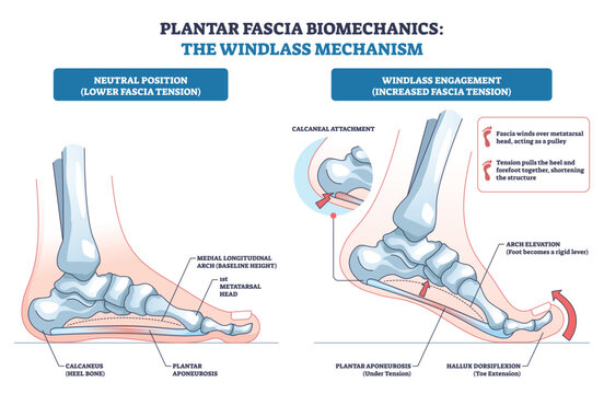 Plantar fascia biomechanics show the windlass mechanism raising the arch as the hallux dorsiflexes, plantar aponeurosis tightens between calcaneus and metatarsal head. Outline diagram