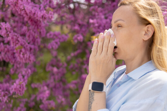 Woman experiencing hay fever symptoms, sneezing and blowing nose outdoors near blooming spring trees, suffering from seasonal allergy to pollen