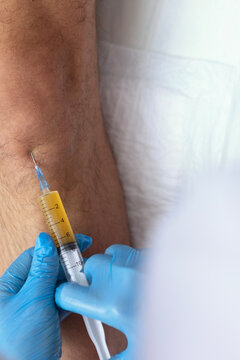 Intraarticular injection of platelet-rich plasma (PRP therapy) into patient's knee for joint treatment in an orthopedic clinic. Plasma therapy procedure in orthopedic clinic. Copy space. Top view