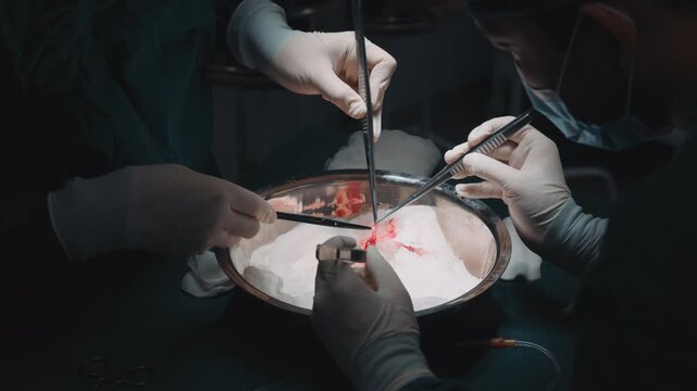 Donor kidney preparation for transplantation by surgeons using precision instruments in a sterile operating room. Organ donation, transplant surgery, healthcare, clinical education and hospital 