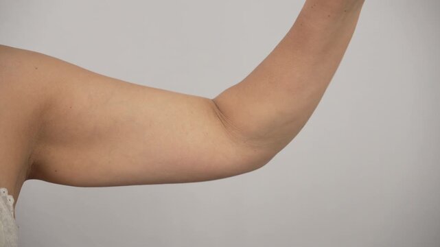 Female Upper Arm Close Up Flexing to Show Loose Skin and Flab