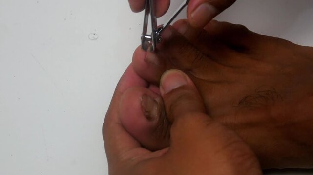 someone is cutting the nails on their toes using a nail clipper