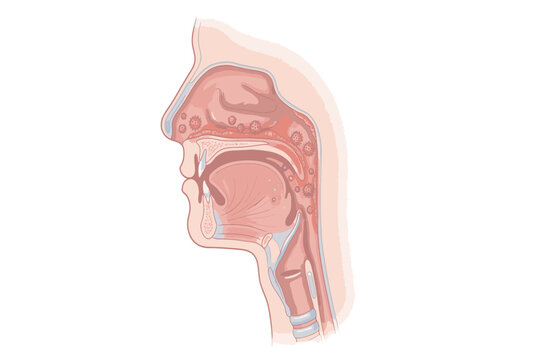 Measles virus affecting respiration illustrating respiratory infection, viral transmission, airway inflammation, symptoms, and infectious disease research.