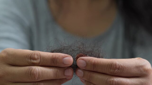 young woman her hair and have many hair loss. problem of maintenance losing by sad strain cancer patients after receiving chemotherapy. Healthcare and medical concept.	