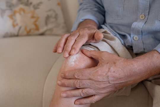 Senior adult applying pain relief cream to knee, managing joint discomfort and arthritis symptoms, finding comfort with topical medication