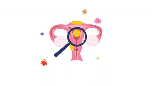 Female Reproductive Gynecology Cervical Screening System Infection Animation Video, Uterus HPV Virus and Medical Inspection Concept