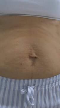 Adult torso receives abdominal massage, with hands pressing skin in medical style closeup. Bare belly and striped drawstring shorts show relaxed body care, with gentle pressure around navel and waist.