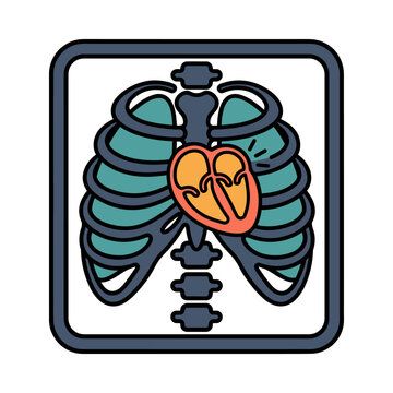 Mechanical Heart Valve Fluoroscopy Icon for Cardiology