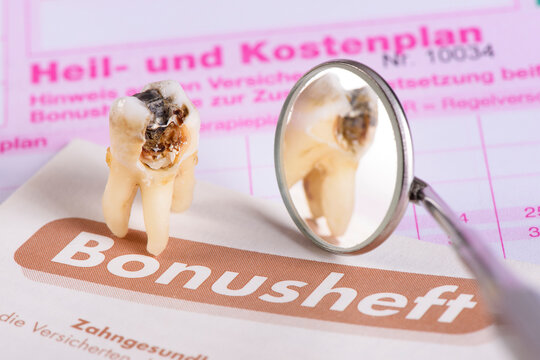 Auf einem Heil- und Kostenplan liegt ein extrahierter Backenzahn mit Karies und Amalgamf&uuml;llung