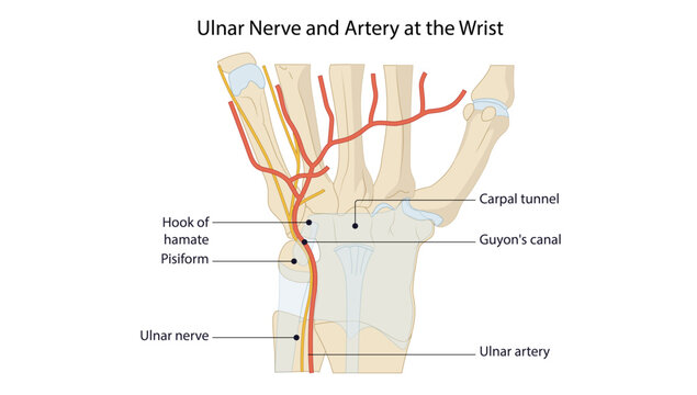 Ulnar Nerve and Artery at the Wrist, Anatomical illustration showing the course of the ulnar nerve and ulnar artery at the wrist, with the carpal tunnel, Guyon&rsquo;s canal, pisiform, and hook of hamate.