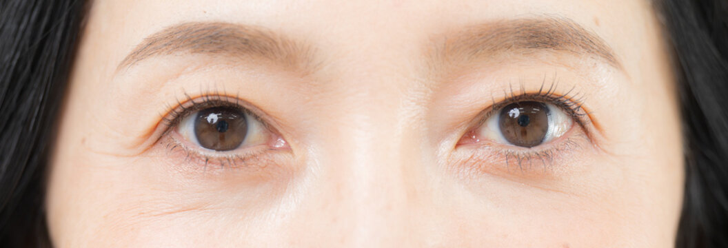 Close-up of an Asian woman in her 50s&rsquo; eye area, featuring crow&rsquo;s feet, signs of aging, and beauty imagery related to eye care and anti-aging&mdash;Close-up