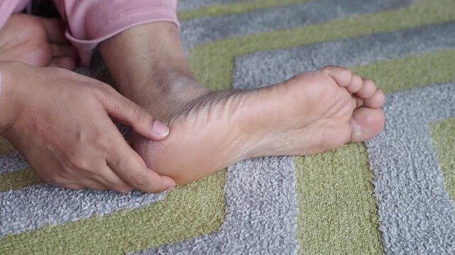 Woman touching dry cracked skin on her heel for moisturizing care