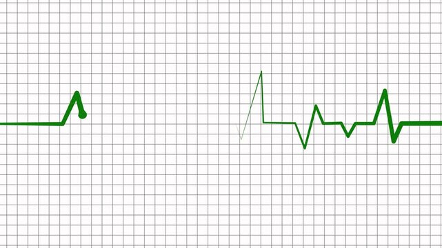 Heartbeat Line Wave Signal Animation with Continuous Pulse and Clear ECG Waveform for Medical Use