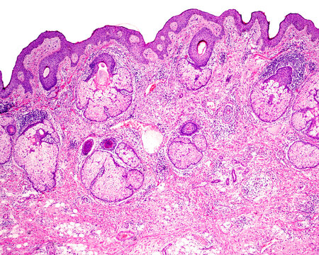 Human auricle skin